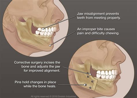 Jaw Surgery Logan, UT - Gregory E. Anderson PC