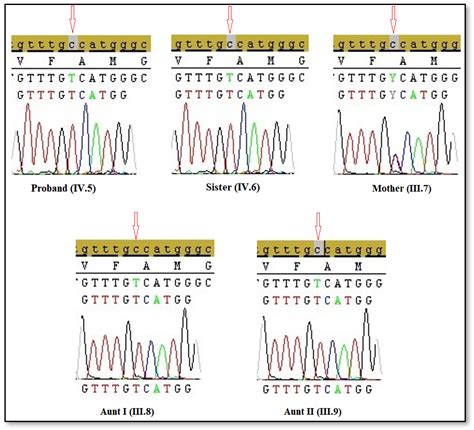 A Novel Mutation in the Androgen Receptor Gene of Female Patients with ...