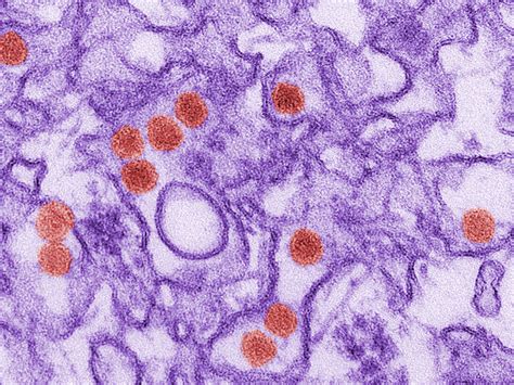 Dengue na gravidez | BabyCenter