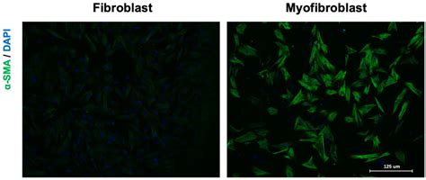 Proteomic Insights into Cardiac Fibrosis: From Pathophysiological ...