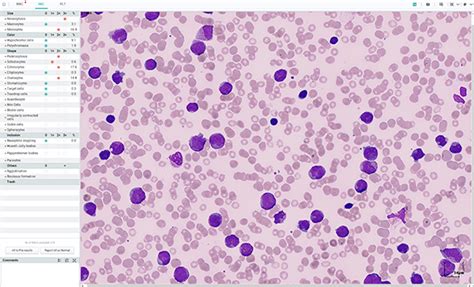 MC-80 Automated Digital Cell Morphology Analyzer | | 5-Diff Hematology ...