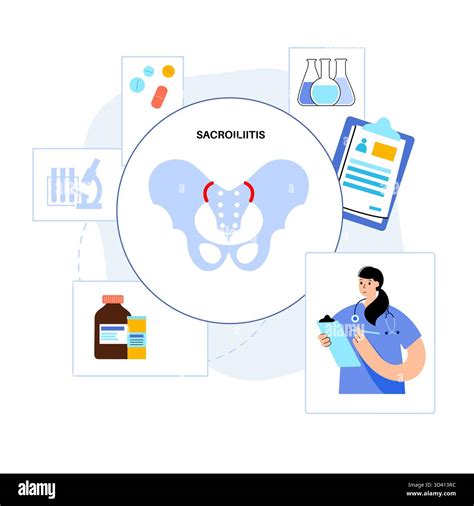 Illustration of sacroiliitis treatment. Sacroiliitis is an inflammatory condition that affects ...