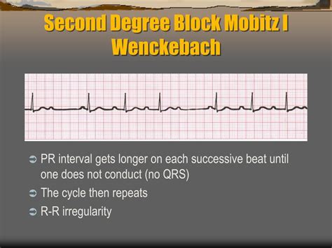Image result for ACLS Code Blue Algorithm