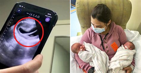 Mom With Heart-Shaped Uterus Defies the Odds to Give Birth to One-in ...