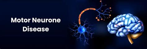 Enfermedad de la neurona motora: síntomas y cuidados