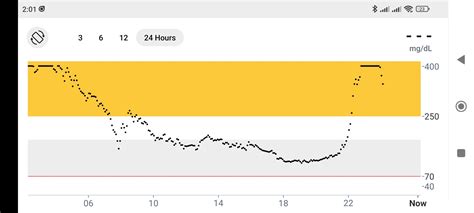 Image result for Dexcom Keeps Loosing Sensor Signal