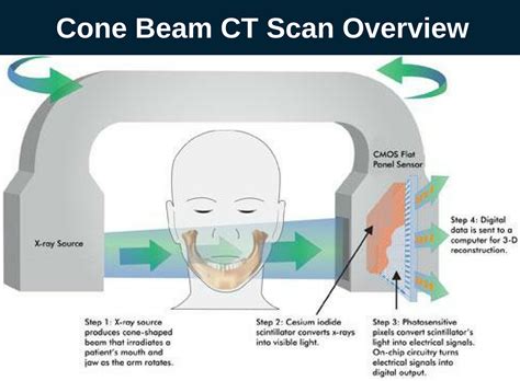 Dental Cone Beam CT Scan Burbank | My Dentist Burbank