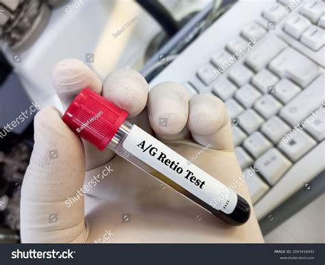 Gamma Globulin: Over 9 Royalty-Free Licensable Stock Photos | Shutterstock