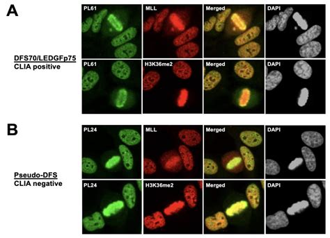 Speckled Antinuclear Antibody