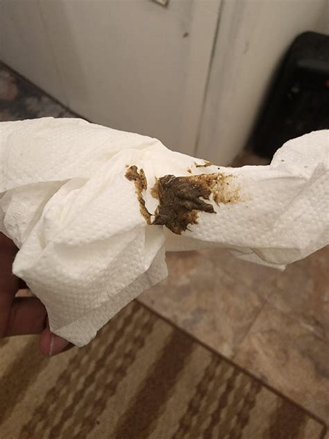 Why Is Poop Hard To Wipe at Roberta Shanklin blog