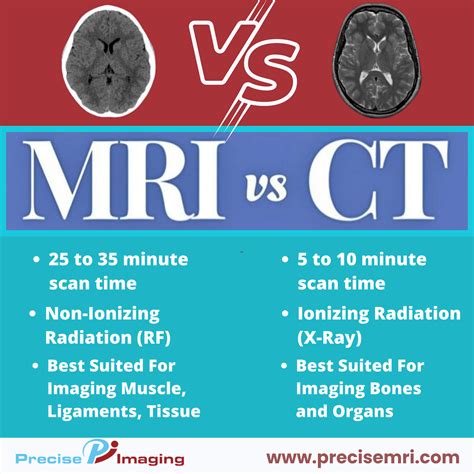 MRI vs. CT Scan: What’s the difference? | Understanding mri imaging ...