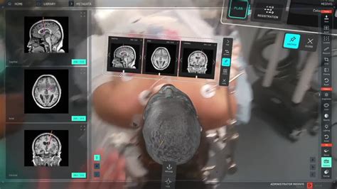 Image result for Pascal OP Surgery