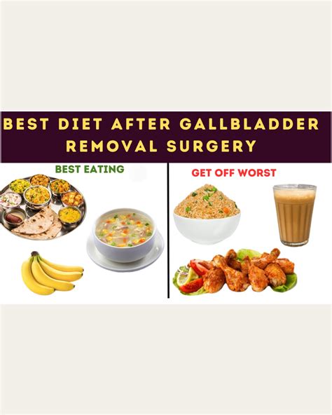 Here s the best diet plan to follow post gallbladder removal surgery – Artofit