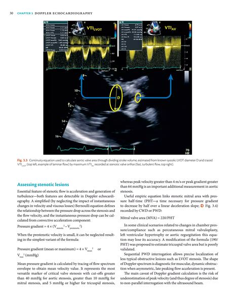 Doppler echocardiography | PDF