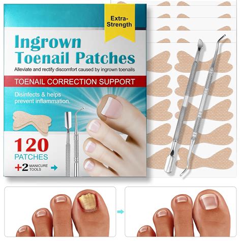 Amazon.com: BWAHBYY Ingrown Toenail Treatment, 120 PCS No Glue Breathable Corrector Patch ...