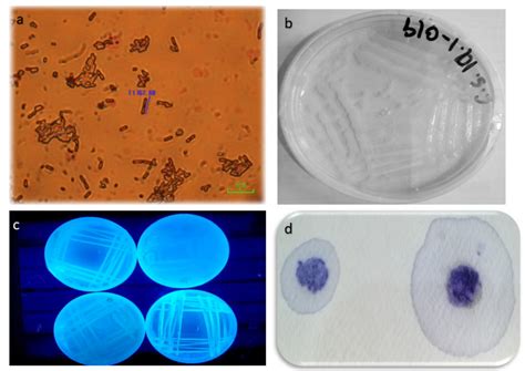 Investigation of Streptomyces scabies Causing Potato Scab by Various ...