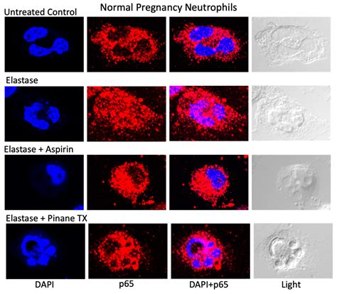 Aspirin Inhibits the Inflammatory Response of Protease-Activated ...