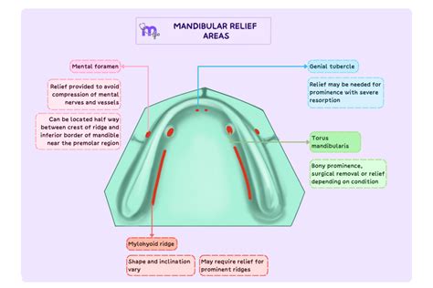 Relief Areas in Maxillary and Mandibular Prosthetics – Medi Study Go
