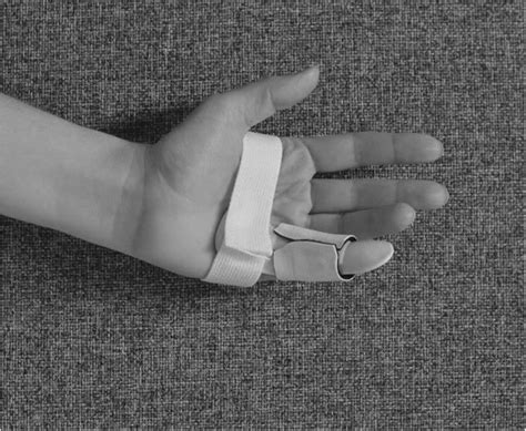 Image result for Finger Gutter Splint
