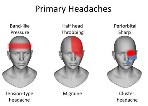 Kuvatulokset haulle causes of headaches