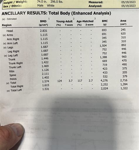 High bone density : r/medical_advice
