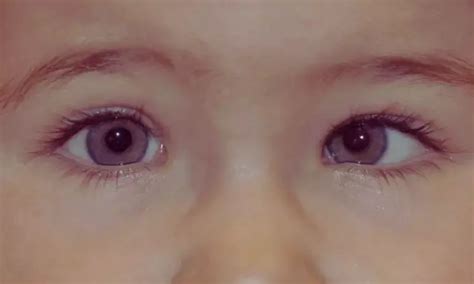 Study Links Maternal Hypertensive Disorders to 82 Percent Higher Risk ...