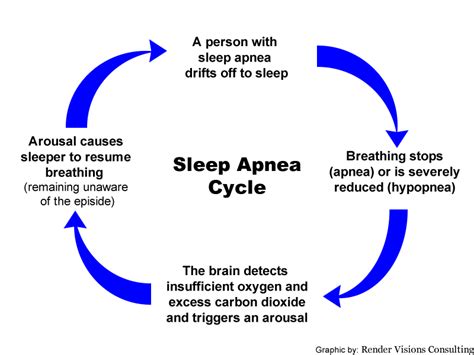 Image result for Sleep Apnea Example