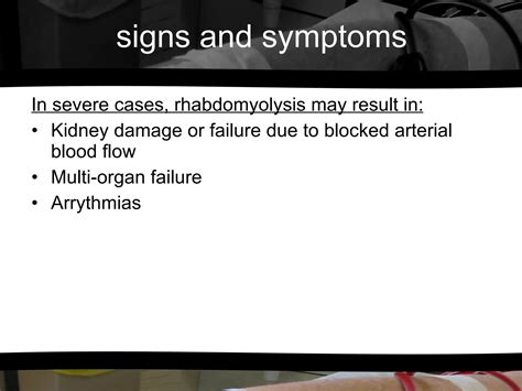 Rhabdomyolysis | PPT