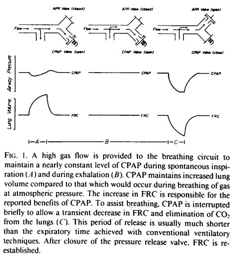 Aprv Pressure Time Graph 的图像结果