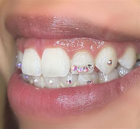 Image result for DIY Tooth Gems