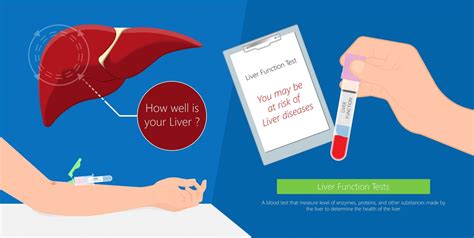 Image result for Liver Function Tests Labs