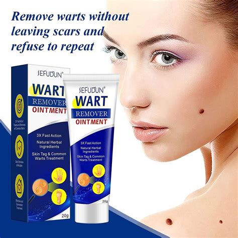 20g Wart Remover Ointment Herbal Ingredients Natural Safe Body Warts Treatment for Acne Moles ...