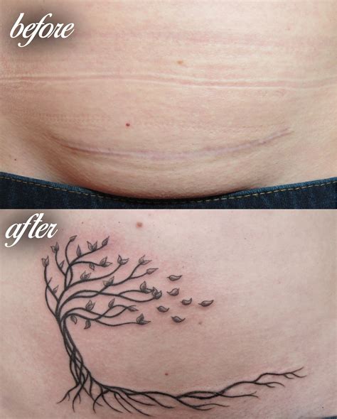 C Section Scar Tattoo