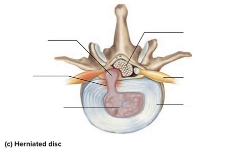 Disk Problem 的图像结果