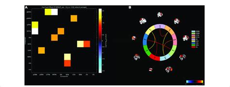 Image result for Connectivity Matrix