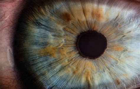 Diabetic Retinopathy Stages: Everything You Need To Know | IRIS