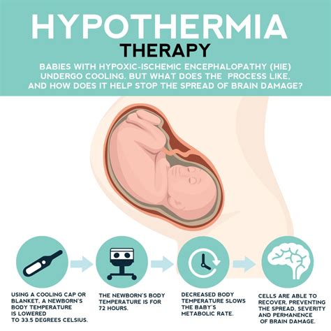 What Is Neonatal Hypothermia at Elizabeth Simson blog