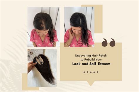 Uncovering Hair Patch to Rebuild Your Look and Self-Esteem – GorgeousHair