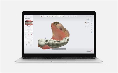 Image result for 3Shape Software