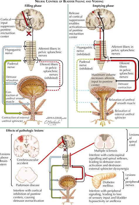 VOIDING DYSFUNCTION - Clinical Tree