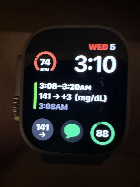 Dexcom G6 App. Add Event 的图像结果