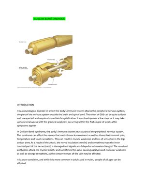 Carpal Tunnel Syndrome - CARPAL TUNNEL SYNDROME ( CTS) MEANING Carpal ...