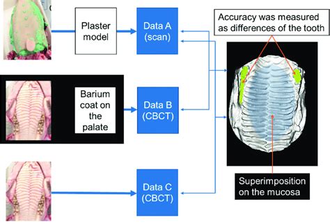 Image result for How to Take Study Models with Plaster Lab