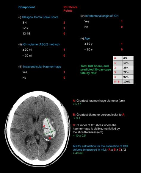 Acute intracerebral haemorrhage: diagnosis and management | Practical Neurology