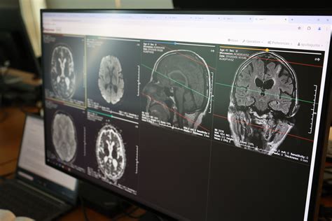 Shining a Light on Brain Tumours: An Interview with Neuroradiologist Dr Geert Lycklama