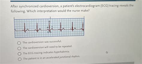 Image result for Synchronized Cardioversion Rhythm Strip