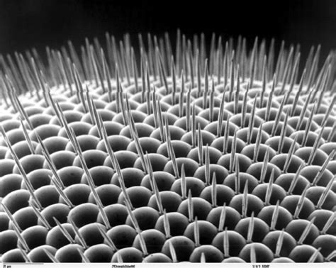 Image result for Electron Microscope Images