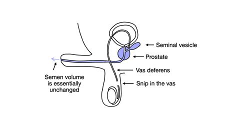Anatomy for Vasectomy – Vasectomy Resources