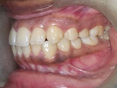 Gallery - PROFILE ORTHODONTICS & COSMETIC DENTISTRY