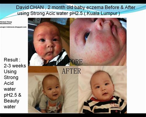 Kangen Alkaline Ionized Water : TESTIMONY